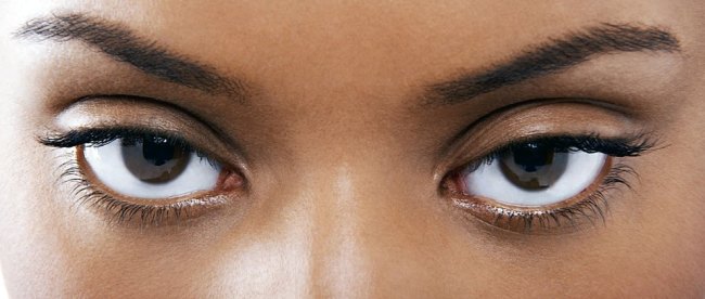 Seputar Mata Bintitan - Alkanna Health